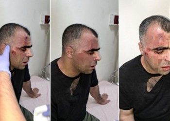 Bitlis’te gazeteciye hücum: Belediye çalışanı ile bir polis açığa alındı