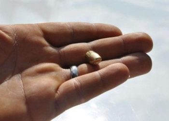 Burdur’da yorgun mermi isabet eden çocuk yaralandı