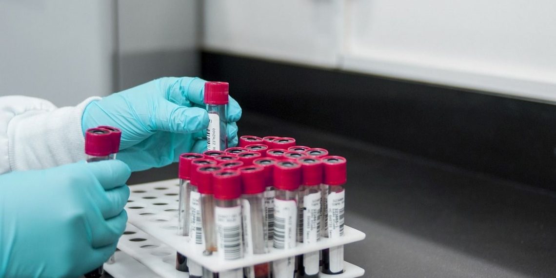 İngiltere’de bulaşıcı cinsel hastalıklar rekor düzeye yükseldi