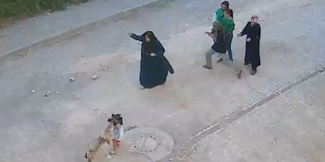 Şanlıurfa’da köpek saldırısına uğrayan çocuk yaralandı