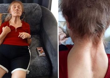 Yürüyerek gittiği hastaneden felçli çıktı