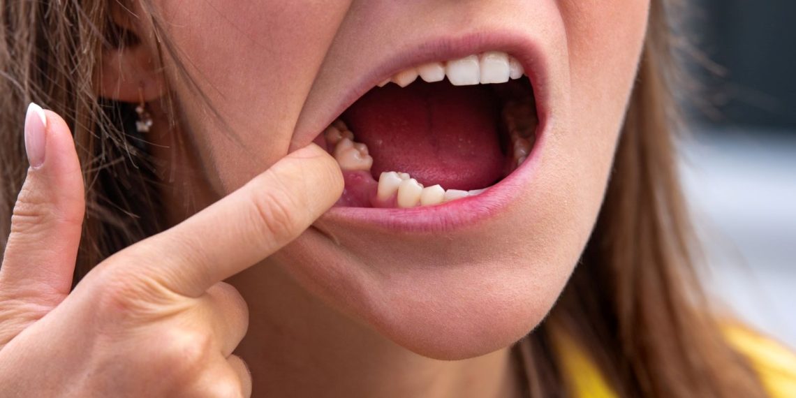 Japonya’da ilaç geliştiriliyor: Dişler tekrar çıkarılabilir