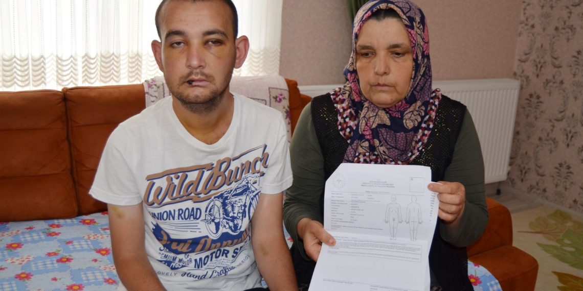 Kas hastası genci kuru otları yaktığı için hastanelik etti