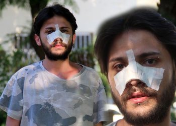 Kiracıya “ucuz kira” dayağı