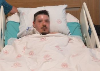 Parlayan mangal jeli yüzünü yaktı