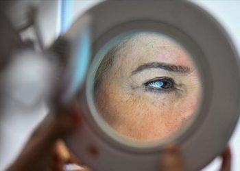 Tarihin en yüksek düzeyi: İngiltere’de cilt kanseri hadiseleri yılda 17 bin 500’e çıktı