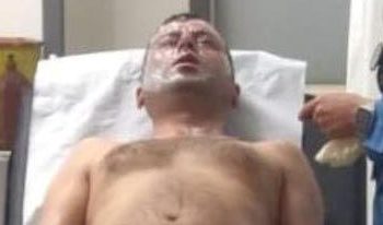 Tıkalı lavaboyu açmak isterken hastanelik oldu