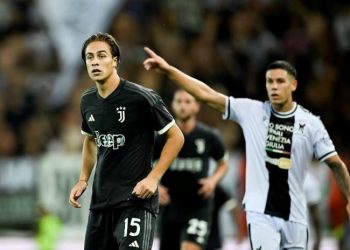 Allegri’den Kenan Yıldız’a ültimatom: “Hemen saçlarını kestirecek”