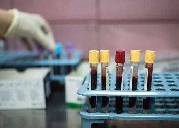 DSÖ’den Covid-19’un yeni varyantları karşısında “daha fazla test” daveti