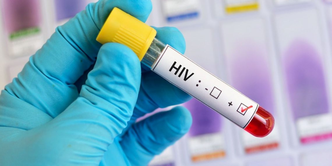 Gana’da AIDS kabusu: Bir yılda 9 bin 354 can kaybı