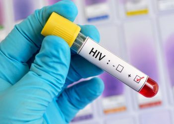 Gana’da AIDS kabusu: Bir yılda 9 bin 354 can kaybı