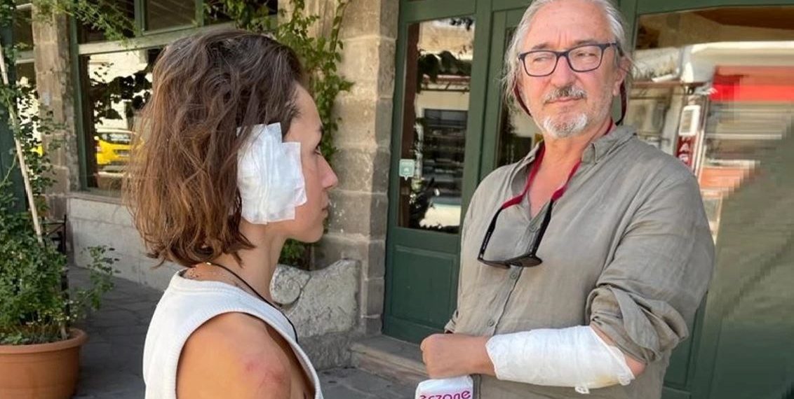 Kapadokya’da köpeklerin saldırısına uğrayan 2 turist yaralandı