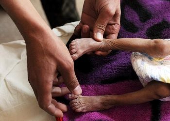 Nijerya’da difteriden ölenlerin sayısı 83’e yükseldi