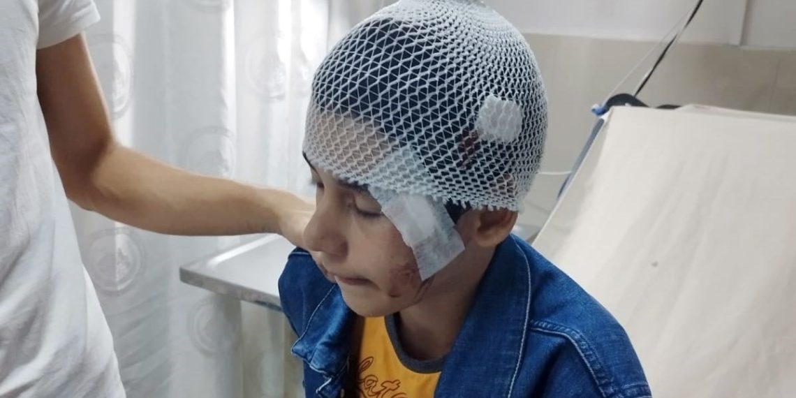 Salıncakta sallanırken yüzüne yorgun mermi isabet etti