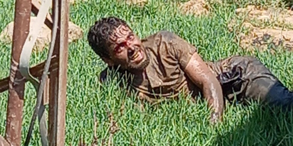 Şanlıurfa’da kuduz hastası hastaneden kaçtı: Vatandaşlar paniğe kapıldı