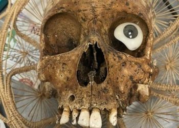 ABD’de şaşırtan bağış: Kafatası gönderildi