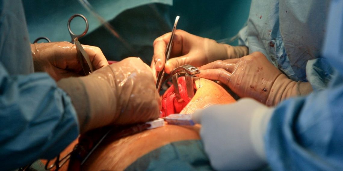 Ameliyatta karında unutulan cerrahi alet 18 ay sonra çıkarıldı