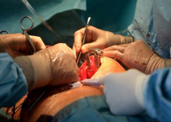 Ameliyatta karında unutulan cerrahi alet 18 ay sonra çıkarıldı