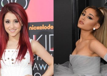 Ariana Grande: Birçok kere botoks yaptırdım