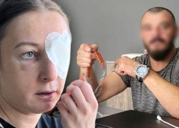 Eski kız arkadaşa dayağa gözaltı