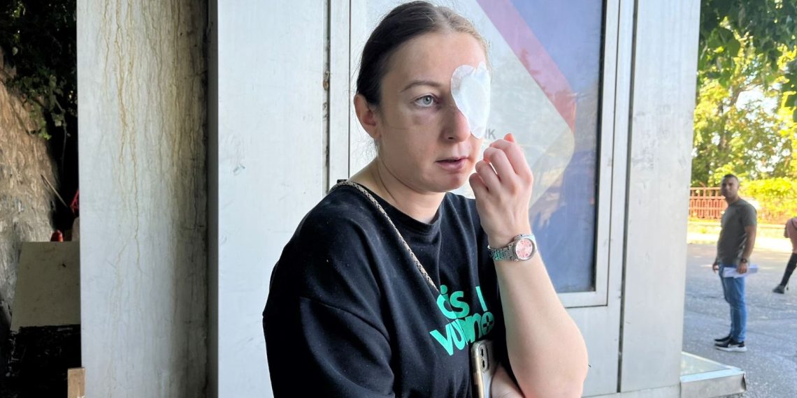 Eski sevgilisi tarafından öldüresiye dövüldü