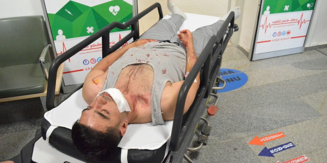 Otobüste ayağına bastığı yolcuyu dövüp palayla yaraladı