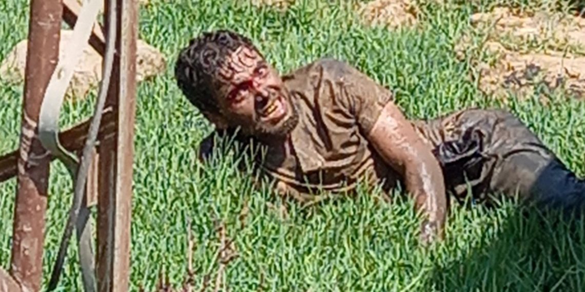 Şanlıurfa’da tedavi gören kuduz hastası hayatını kaybetti