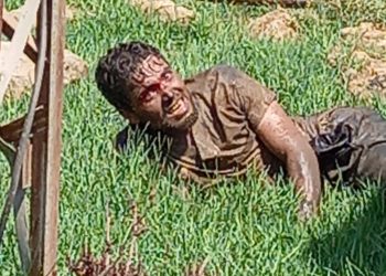 Şanlıurfa’da tedavi gören kuduz hastası hayatını kaybetti