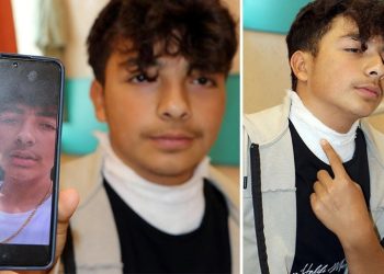 Üzerine yıldırım düşen gencin boynundaki kolye parçalandı