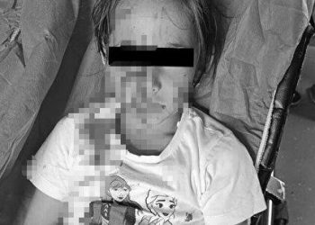 6 yaşındaki çocuk köpek taarruzunda yaralandı