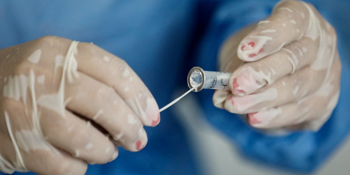 Brezilya’da Covid-19 olayları arttı: Test merkezlerinde yoğunluk yaşanıyor