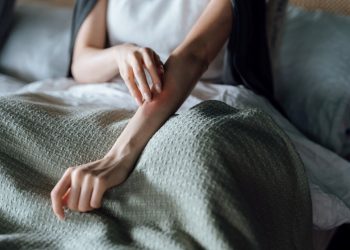 Covid- 19 hadiselerinde “deride döküntü” tehlikesi