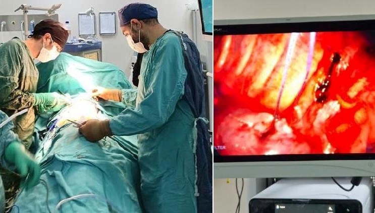 Hengamede akciğerine bıçak saplandı