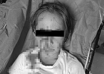 İstanbul Valiliği’nden “Esenyurt’ta Kuduz Paniği” paylaşımlarına yönelik açıklama