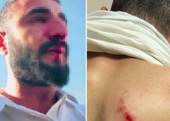 Kaçak elektrik kontrolüne giden görevlilere hücum