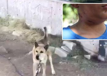 Sevmek istediği köpek boynundan yaraladı