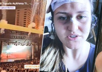 Ünlü müzikçinin konserinde başına demir düştü | Duyma yetisini kaybeden bayan tazminat davası açtı