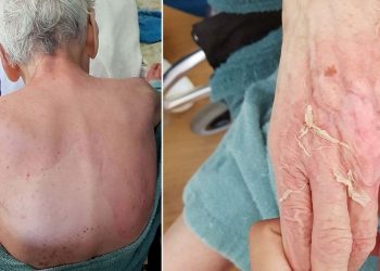 Bakımevinde kuşkulu ölüm  | Az hastalık denildi, İsimli Tıp raporu çalışanları yalanladı