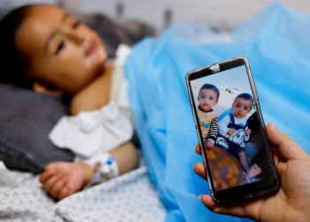 BM: Gazze’de öldürülenlerin yüzde 70’i çocuklardan ve bayanlardan oluşuyor