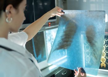 Dünyanın ikinci ölümcül bulaşıcı hastalığı tüberküloz 7,5 milyon bireyde görüldü