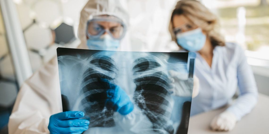 İngiltere’de birinci sefer görüldü: Endişelendiren virüs