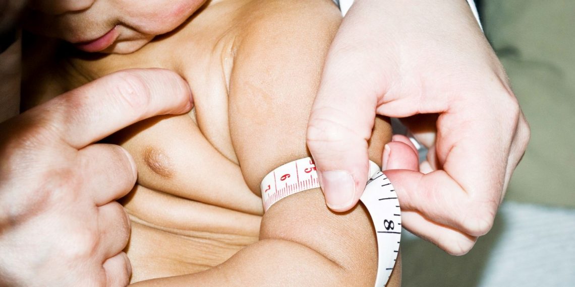 İran’ın en ağır bebeği doğdu