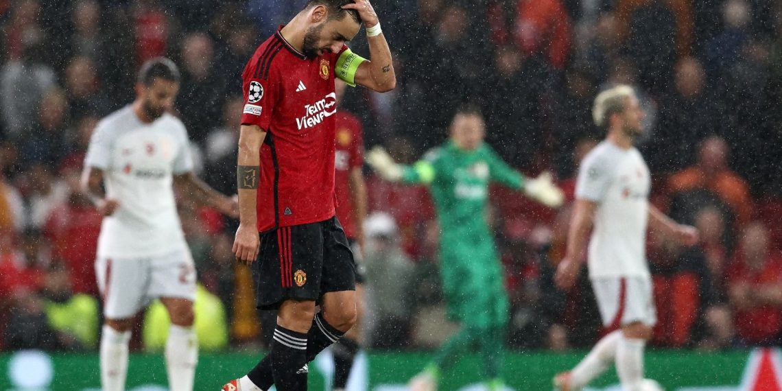 Manchester United, İstanbul’a 7 eksikle geliyor