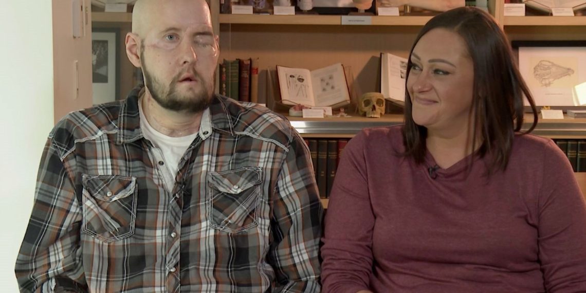 Tıp tarihinde bir birinci: Tam göz nakli yapıldı