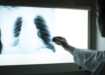 Verem hastalığı nedir, belirtileri nelerdir? Verem hastalığı bulaşıcı mı?