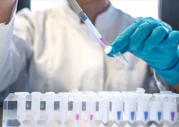 “AIDS Türkiye’de 8-10 kat arttı”