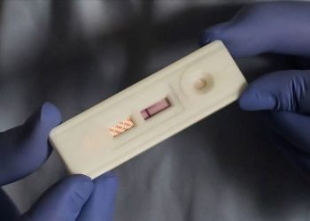 HIV’de umut veren ilaç