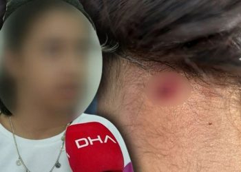 11 yaşındaki İrem maganda kurşunuyla vuruldu