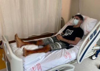 Lavabo açıcı bomba üzere patladı, bedeninin yüzde 35’i yandı