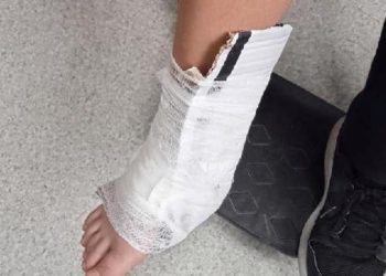 Trabzon’da öğrencinin ayak bileğine “kartonlu birinci yardım”a inceleme